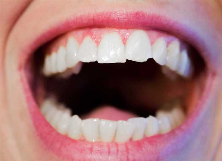 Konya Çürük ve Kırık Diş Tedavisi