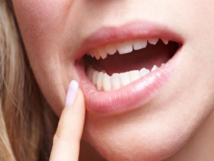 Konya Diş Eti Tedavisi ve Hastalıkları